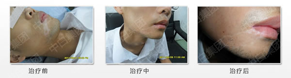 Ҳڽǰ综߿