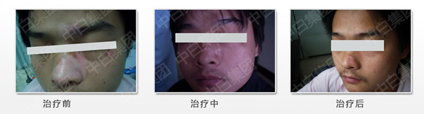 <b>ڶͰ综߿1</b>
